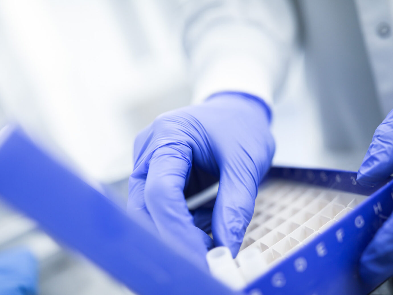 Gloved hand reaching into a multi-well sample tray
